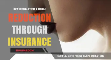 Qualifying for Breast Reduction: Insurance Coverage Guide and Tips