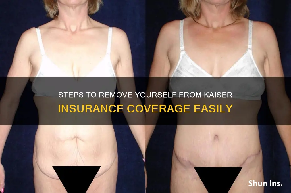 how to remove myself from kasier insurance