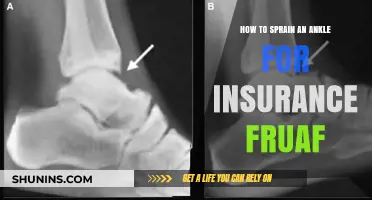 Faking Ankle Injuries for Insurance Fraud: Risks and Consequences