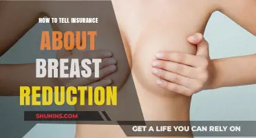 How to Inform Your Insurance Provider About Breast Reduction Surgery
