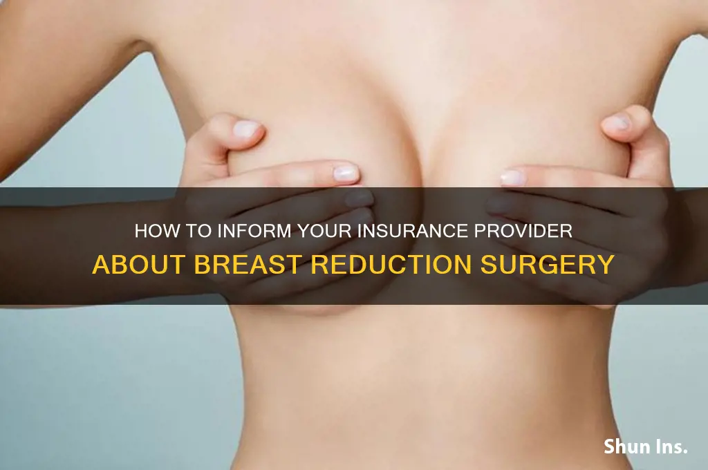 how to tell insurance about breast reduction