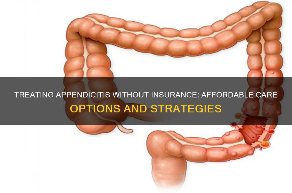 how to treat patients with appendicitis with no insurance