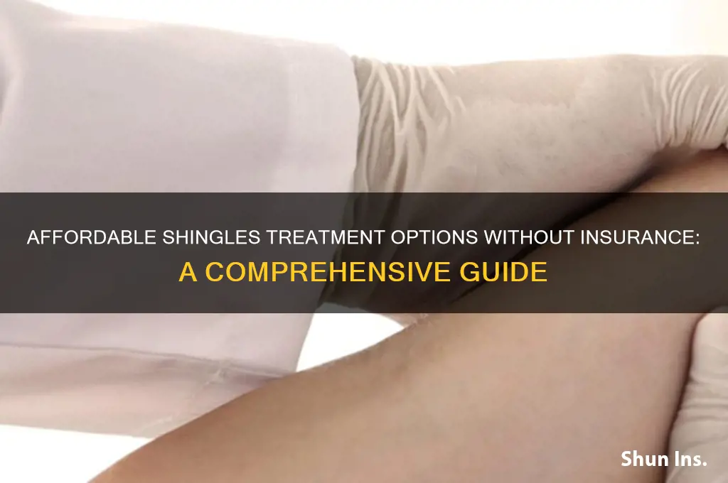 how to treat shingles no insurance
