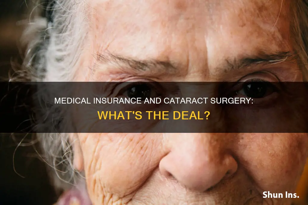 is a complete medical insurance policy necessary for cataract surgery