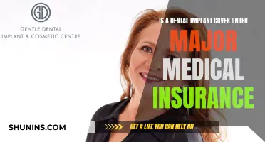 Dental Implant Coverage: Major Medical Insurance Options
