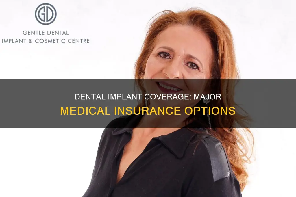 is a dental implant cover under major medical insurance