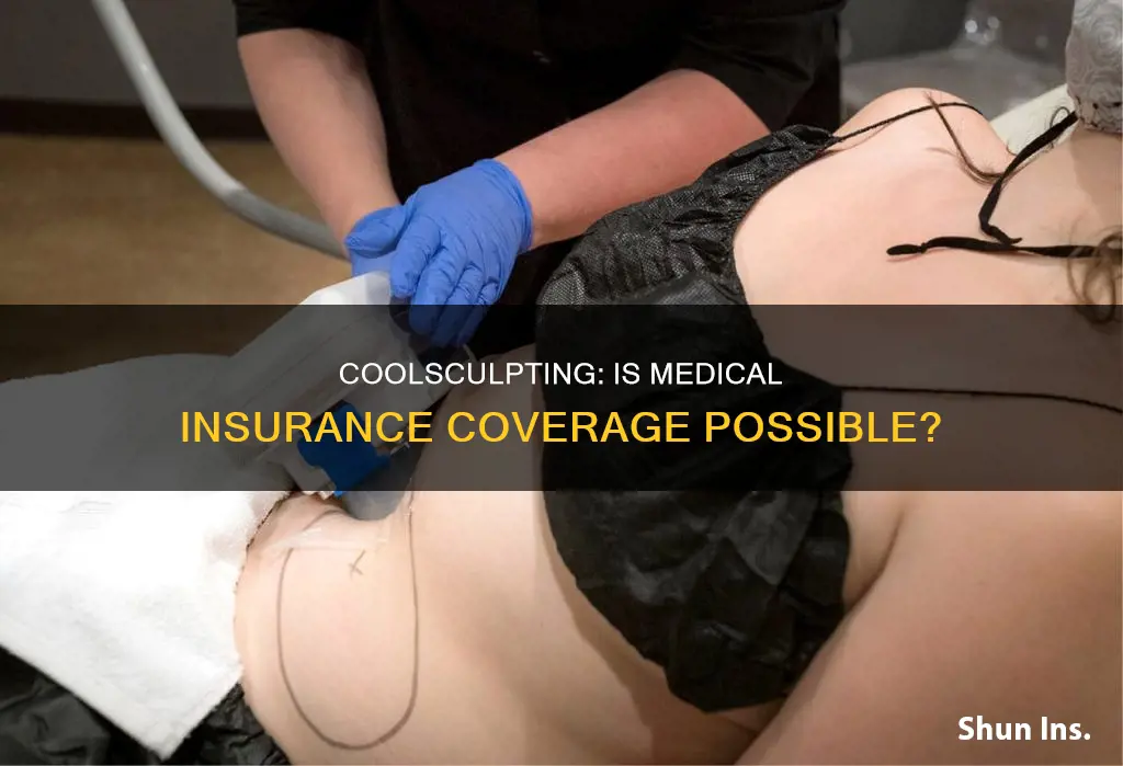 is a medical insurance cover coolsculpting