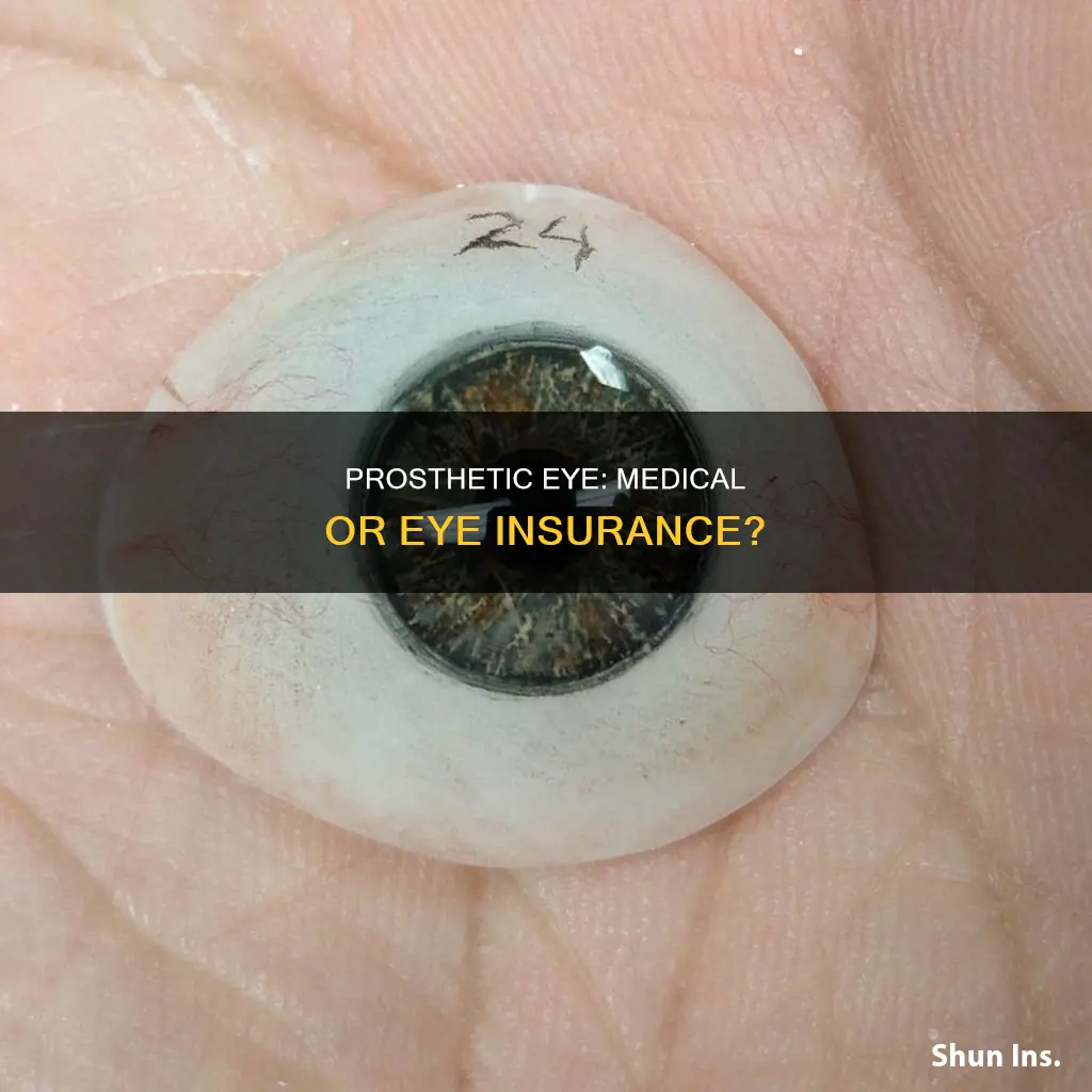is a prosthetic eye medical or eye insurance