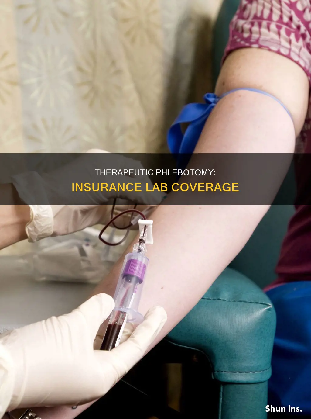 is a therapeutic phlebotomy considered a lab with most insurance