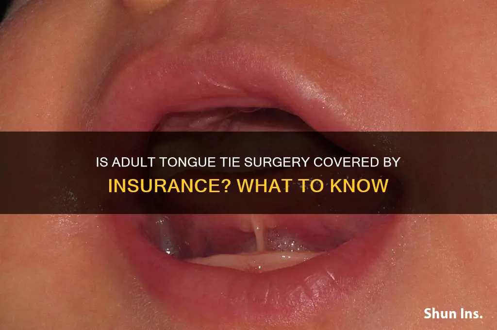 is adult toung tie surgery coverd by insurance
