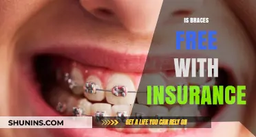 Does Insurance Cover Braces? Understanding Your Orthodontic Benefits