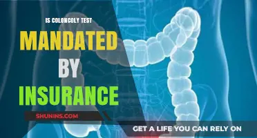 Is Colonoscopy Testing Mandated by Insurance? What You Need to Know
