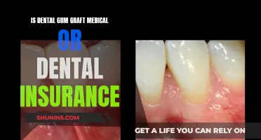 Gum Grafts: Medical or Dental Insurance Coverage?