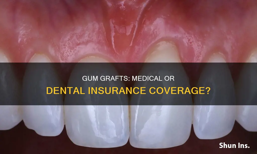 is dental gum graft medical or dental insurance