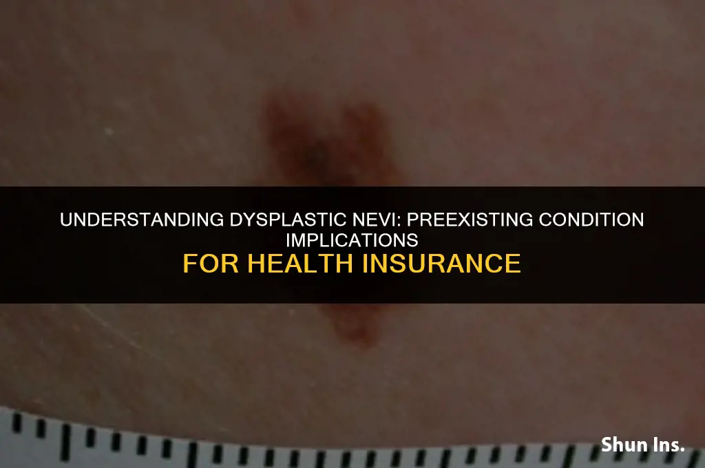 is dysplastic nevi a preexisting condition for health insurance