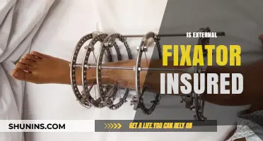Is External Fixator Surgery Covered by Insurance? What You Need to Know
