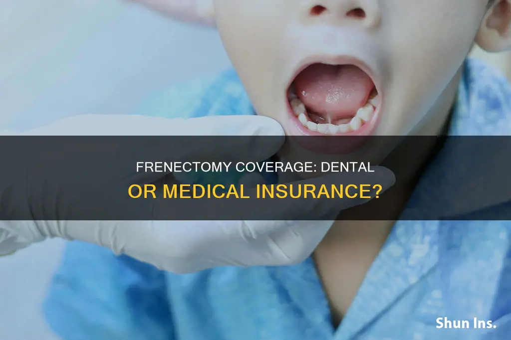 is frenectomy dental or medical insurance