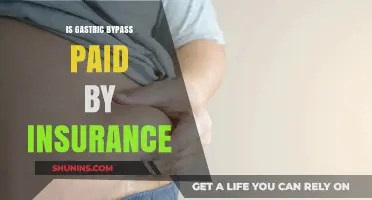 Does Insurance Cover Gastric Bypass Surgery? Costs and Coverage Explained