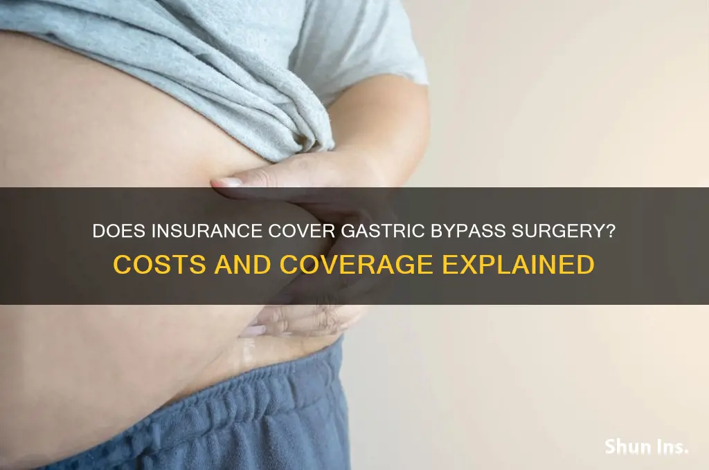 is gastric bypass paid by insurance
