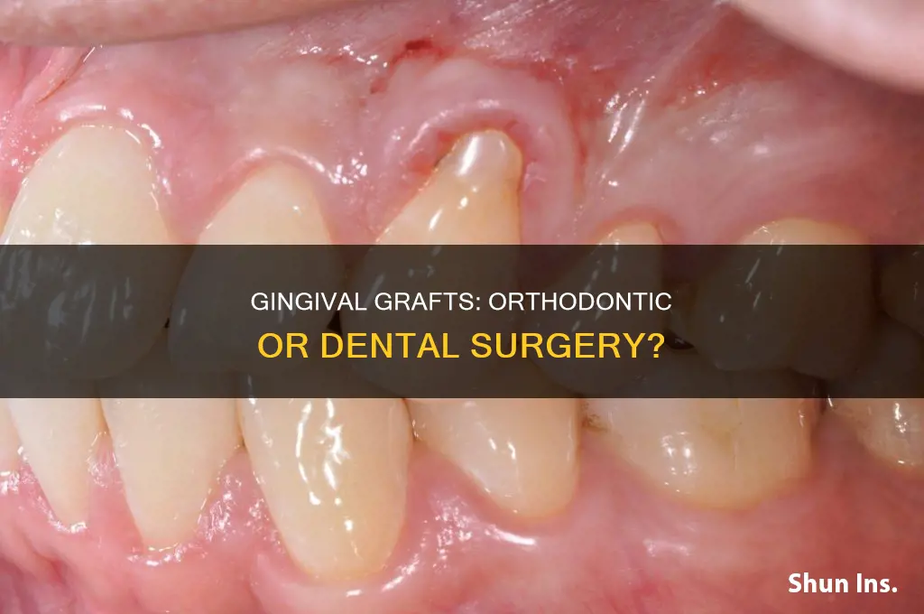 is gingival graft considered orthodontic for insurance purposes