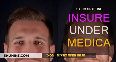 Gum Grafting: Is It Covered by Medicare?