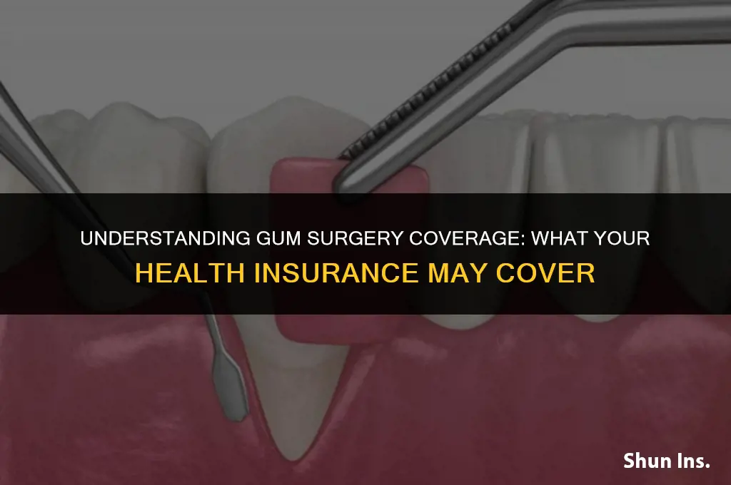 is gum surgery covrered by standard health insurance