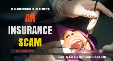 Wisdom Teeth Removal: Insurance Scam or Necessary Procedure?
