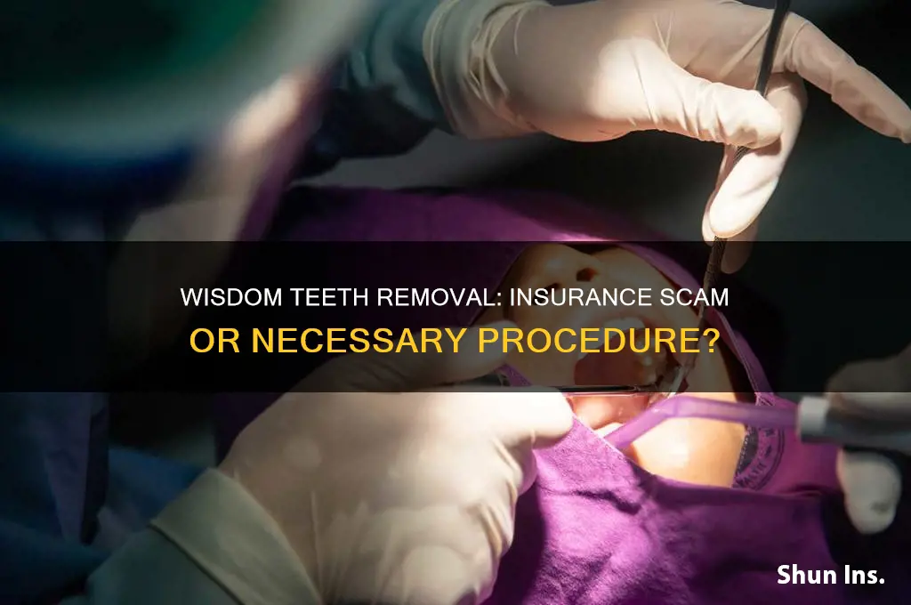 is having wisdom teeth removed an insurance scam