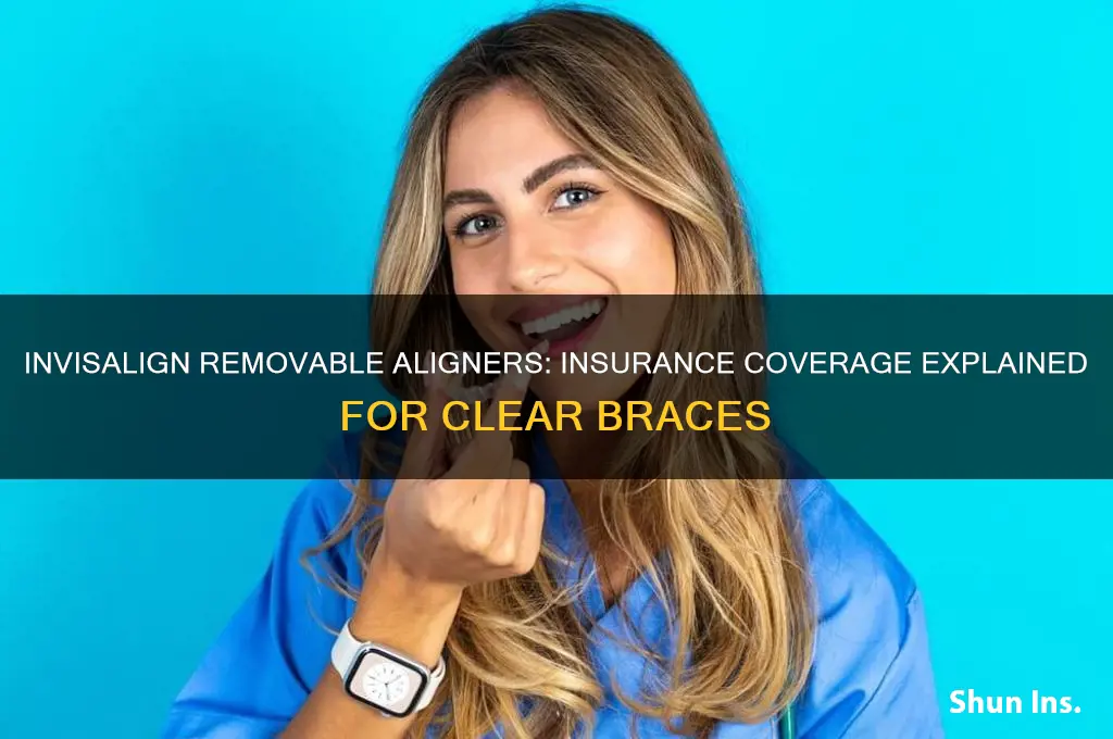is invisalign removable acrylic aligners insurance