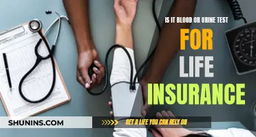 Life Insurance Medical Exam: Blood or Urine Test?