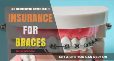 Evaluating the Benefits of Private Health Insurance for Braces: A Comprehensive Guide