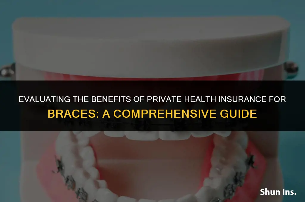 is it worth having private health insurance for braces