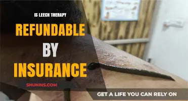 Is Leech Therapy Covered by Insurance? Exploring Reimbursement Options