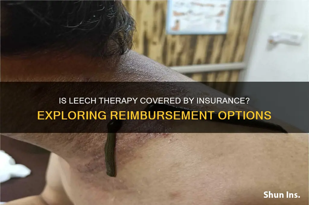 is leech therapy refundable by insurance