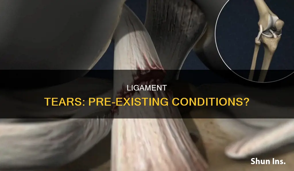 is ligament tear considered pre existing condition by insurance