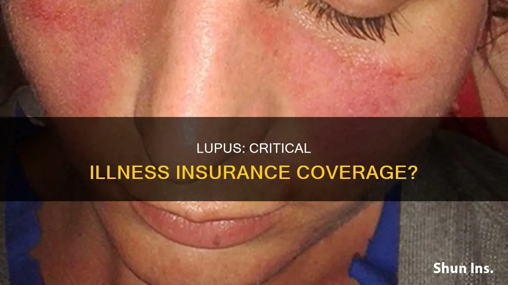 is lupus considered a critical illness for critical illness insurance