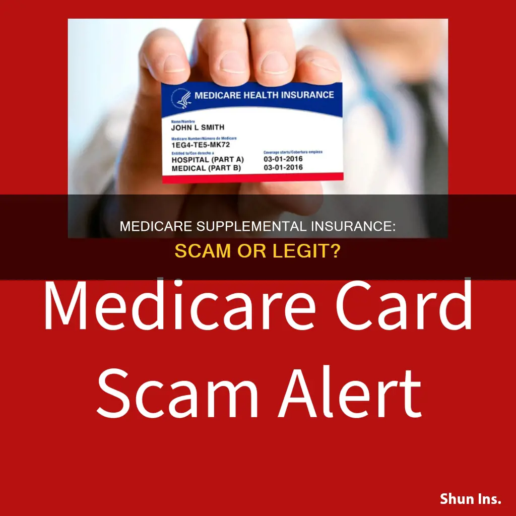 is medicare supplemental insurance a scam