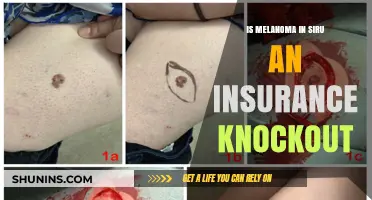 Melanoma in Situ: Insurance Implications and Coverage Challenges Explored