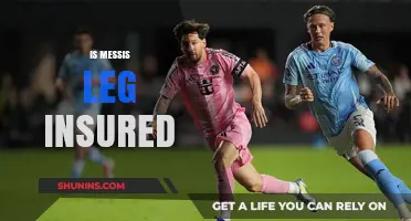 Is Messi's Leg Insured? Exploring the Value of His Limbs