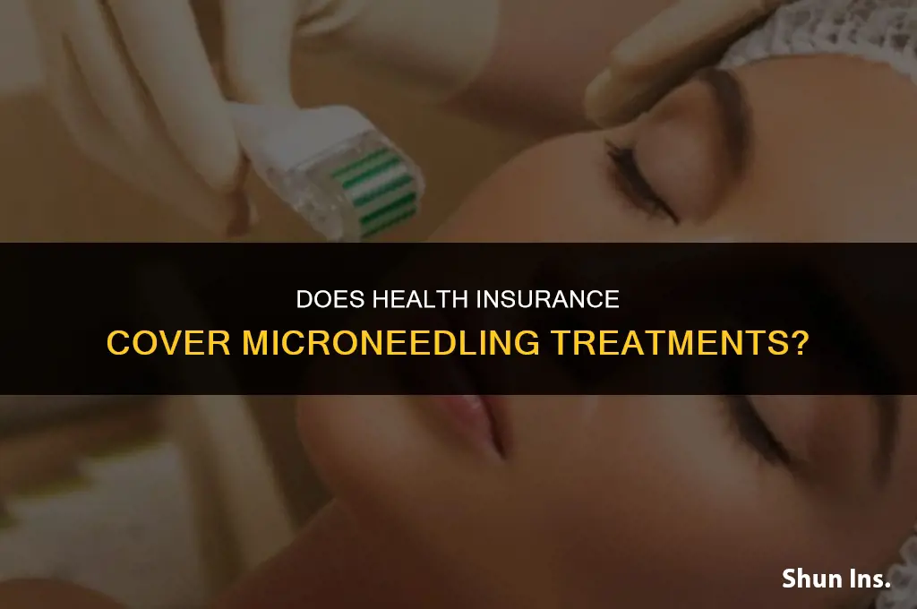 is microneedling included in health insurance