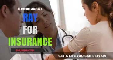 MRI vs. X-Ray: Insurance Coverage Differences Explained