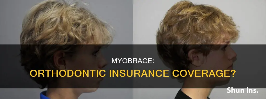 is myobrace considered orthodontics by insurance