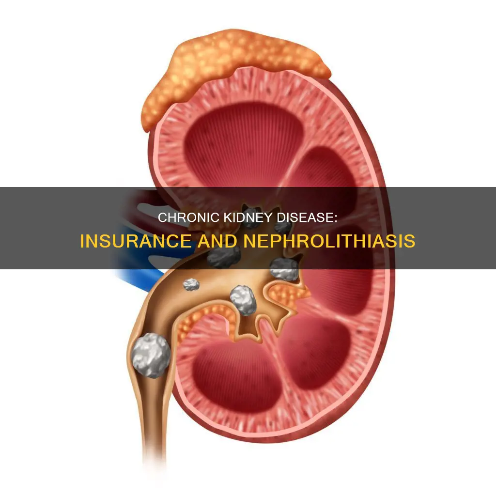 is nephrolithiasis considered a chronic kidney disease for insurance purposes