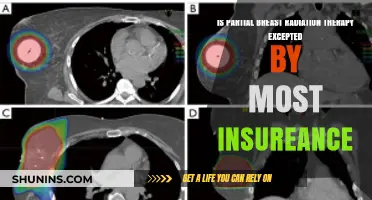 Is Partial Breast Radiation Therapy Covered by Most Insurance Plans?