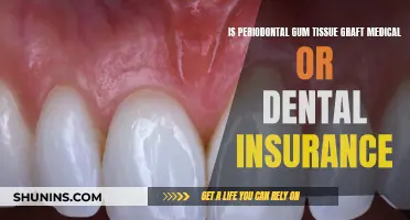 Gum Tissue Grafts: Medical or Dental Insurance?