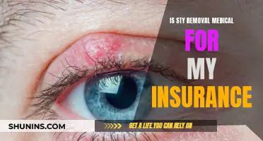 Sty Removal: Is It Covered by My Insurance?