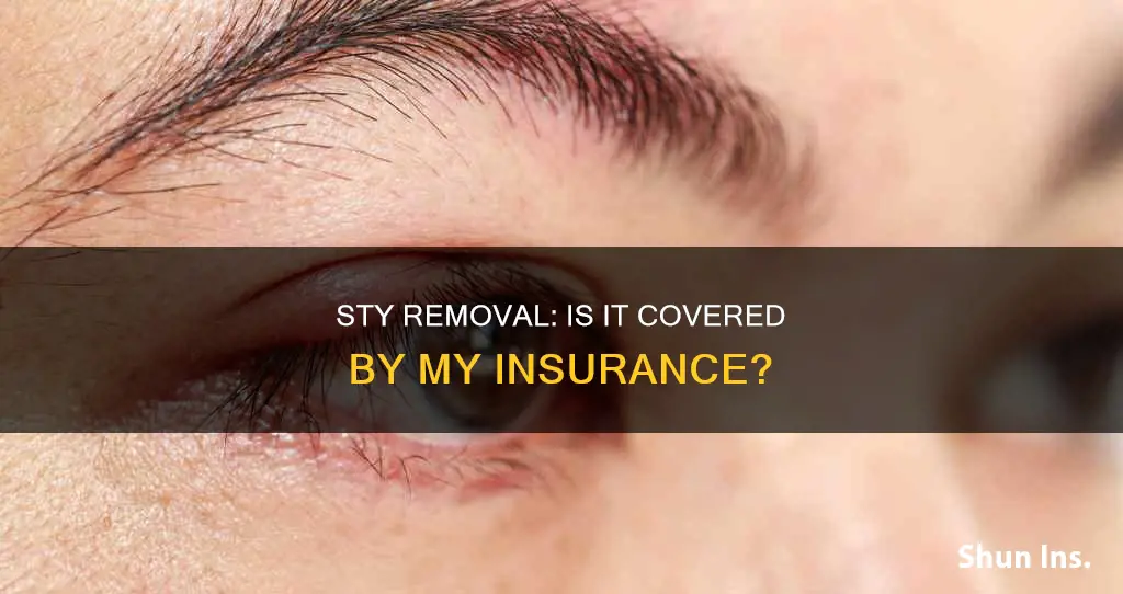 is sty removal medical for my insurance