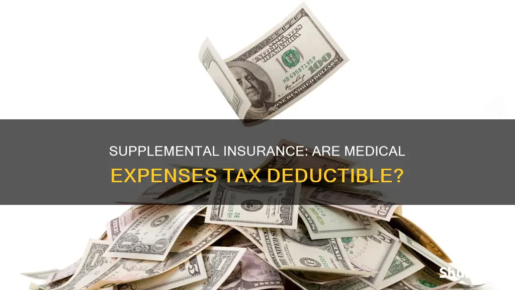 is supplement medical insurance tav deducktable