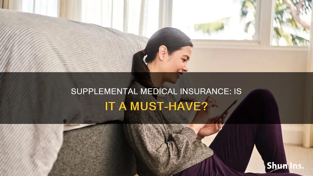 is supplemental medical insurance mandatory
