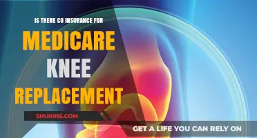 Knee Replacement and Medicare: Understanding Co-Insurance Costs